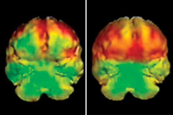 OB-XG208_0426br_G_20130426130759