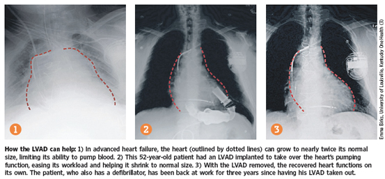 OB-ZC430_Hearts_G_20130930205209