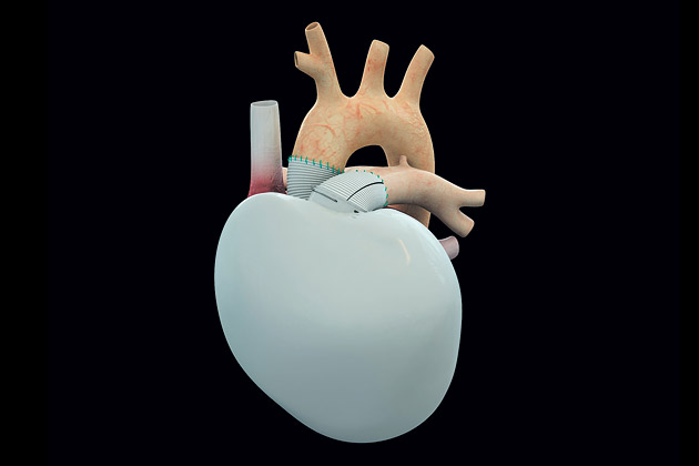 tech_heart42__01__630x420